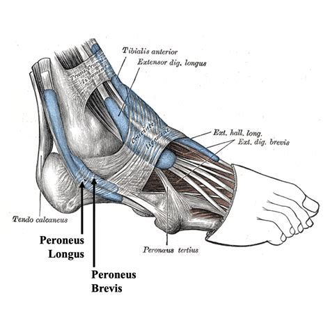 pernoes|Peroneus brevis tear .